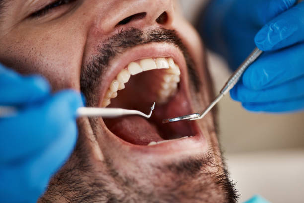 Best Same-Day Emergency Dentist in Waurika, OK
